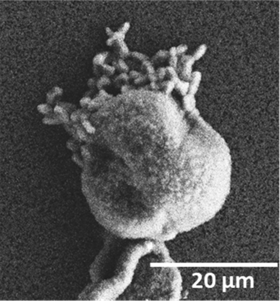 A bur oak pollen about 20 microns wide ruptures in the presence of high moisture. Such a “rupture event” releases hundreds of starch granules as small as a micron wide. Breathed in, particles that small pose a threat to human health. Steiner has researched the climate drivers of rupture events. Image is courtesy of the journal Environmental Science & Technology Letters.
