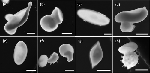 For a 2016 paper, China assembled representative scanning electron microscope images of fungal spores collected in the Amazon basin. The scale bar is 2 microns, space enough for four red blood cells.